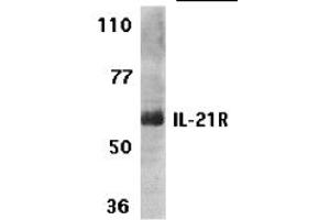 Western Blotting (WB) image for anti-Interleukin 21 Receptor (IL21R) (N-Term) antibody (ABIN1031410) (IL21 Receptor anticorps  (N-Term))
