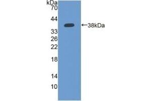 Detection of Recombinant IFI35, Human using Polyclonal Antibody to Interferon Inducible Protein 35 (IFI35) (IFI35 anticorps  (AA 2-286))