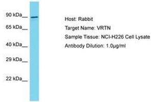 Image no. 1 for anti-Vertebrae Development Associated (VRTN) (AA 568-617) antibody (ABIN6750624) (VRTN anticorps  (AA 568-617))