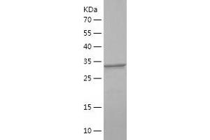 Western Blotting (WB) image for Insulin Receptor Substrate 2 (IRS2) (AA 1035-1136) protein (His-IF2DI Tag) (ABIN7123447)