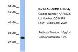 Image no. 1 for anti-Survival of Motor Neuron 1, Telomeric (SMN1) (C-Term) antibody (ABIN6749972) (SMN1 anticorps  (C-Term))