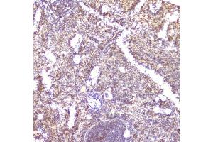 anti-Chemokine (C-C Motif) Ligand 6 (CCL6) (AA 22-116) antibody