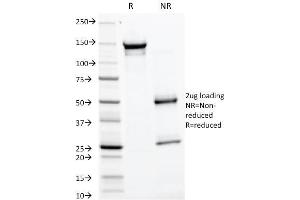 SDS-PAGE Analysis Purified GP2 Mouse Monoclonal Antibody (GP2/1805). (GP2 anticorps  (AA 35-179))