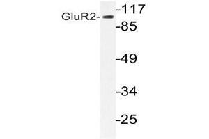Western blot analysis of GluR2 antibody in extracts from HUVEC cells. (GRIA2 anticorps)