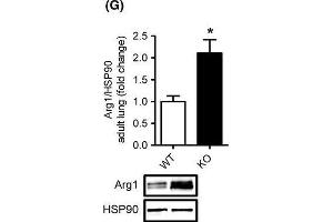 Elevated right ventricular pressure, increased right ventricular weight and altered expression of Ddah1 and Arg1 in cavin-/- mice.