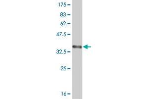 Western Blot detection against Immunogen (36. (ABL2 anticorps  (AA 743-842))
