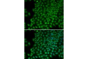 Immunofluorescence (IF) image for anti-Polymerase (RNA) I Polypeptide C, 30kDa (POLR1C) (AA 1-200) antibody (ABIN3020841) (POLR1C anticorps  (AA 1-200))