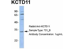Host:  Rabbit  Target Name:  KCTD11  Sample Type:  721_B  Antibody Dilution:  1. (KCTD11 anticorps  (N-Term))
