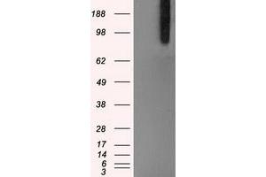 Image no. 5 for anti-B-Raf proto-oncogene, serine/threonine kinase (BRAF) antibody (ABIN1496961)
