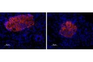 Expression of P2X7 Receptor in rat pancreas - Immunohistochemical staining of rat paraffin-embedded endocrine and exocrine pancreas sections using Anti-P2X7 Receptor Antibody (ABIN7043576, ABIN7045076 and ABIN7045077), (1:50), followed by goat anti-rabbit-AlexaFluor-555-secondary antibody (1:500), (red).