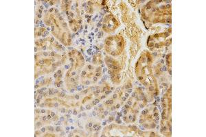 Immunohistochemistry of paraffin-embedded mouse kidney using ACADM antibody at dilution of 1:200 (x400 lens)