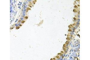 Immunohistochemistry of paraffin-embedded Mouse lung using KLK11 Polyclonal Antibody at dilution of 1:100 (40x lens). (Kallikrein 11 anticorps)