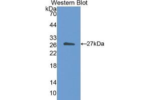 Western blot analysis of the recombinant protein. (CETP anticorps  (AA 81-311))