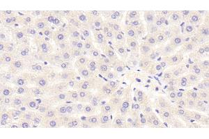 Detection of NOX3 in Rat Liver Tissue using Polyclonal Antibody to Nicotinamide Adenine Dinucleotide Phosphate Oxidase 3 (NOX3) (NOX3 anticorps  (AA 221-466))