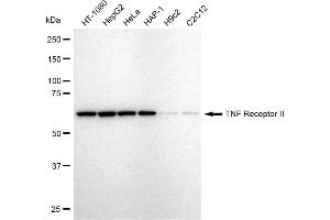 Western blotting analysis using TNF Receptor II antibody (ABIN7800676).