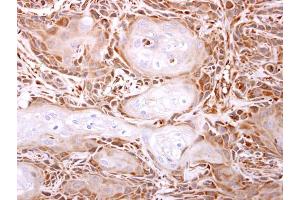 IHC-P Image ITPase antibody [N1C3] detects ITPase protein at cytosol on Ca922 xenograft by immunohistochemical analysis. (ITPA anticorps)