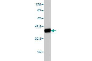 Western Blot detection against Immunogen (37. (ITGA4 anticorps  (AA 98-207))