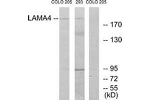 Western blot analysis of extracts from COLO/293 cells, using LAMA4 Antibody. (LAMa4 anticorps  (AA 481-530))