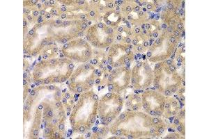 Immunohistochemistry of paraffin-embedded Mouse kidney using CARD10 Polyclonal Antibody at dilution of 1:100 (40x lens). (CARD10 anticorps)