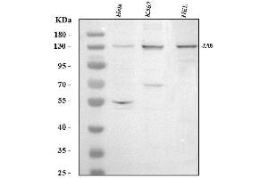 Western blot analysis of Exportin-5/XPO5 using anti-Exportin-5/XPO5 antibody (ABIN5518968).