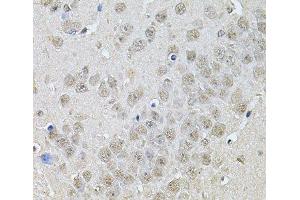 Immunohistochemistry of paraffin-embedded Mouse brain using DR1 Polyclonal Antibody at dilution of 1:100 (40x lens).