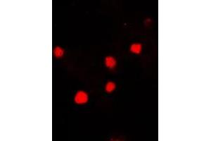 Immunofluorescent analysis of Histone H2A. (H2AFX anticorps  (C-Term))