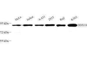 Western blot analysis of DDX18 (ABIN7073695) at dilution of 1: 500 (DDX18 anticorps)