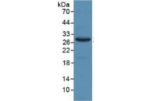 WB of Protein Standard: different control antibodies against Highly purified E.
