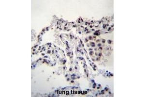 MEIG1 Antibody (Center) immunohistochemistry analysis in formalin fixed and paraffin embedded human lung tissue followed by peroxidase conjugation of the secondary antibody and DAB staining. (MEIG1 anticorps  (Middle Region))