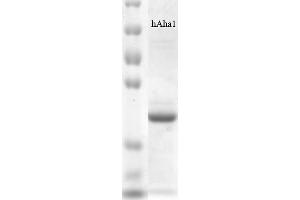 SDS PAGE of human his-tagged Aha1 protein (ABIN1686726, ABIN1686727 and ABIN1686728).