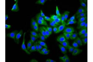 Immunofluorescence staining of HepG2 cells with ABIN7167772 at 1:266, counter-stained with DAPI. (GUCY2D anticorps  (AA 362-462))