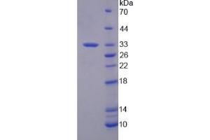 SDS-PAGE analysis of Human SF3B1 Protein. (SF3B1 Protéine)
