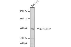 Western blot analysis of extracts of Rat lung, using VEGFR3/FLT4 antibody (ABIN6130779, ABIN6140698, ABIN6140701 and ABIN6217251) at 1:1000 dilution. (FLT4 anticorps  (AA 1174-1363))