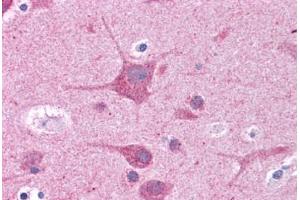 Human Brain, Cortex: Formalin-Fixed, Paraffin-Embedded (FFPE)