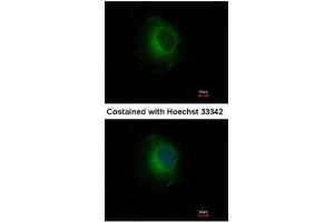 ICC/IF Image Immunofluorescence analysis of methanol-fixed HeLa, using Plasminogen, antibody at 1:500 dilution. (PLG anticorps)