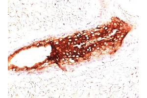Formalin-fixed, paraffin-embedded human skin stained with CK17 Monoclonal Antibody (SPM560).