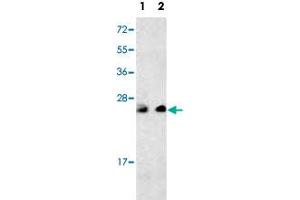 Western blot analysis of multiple cells cell lysate (35 ug/lane) with PTP4A3 polyclonal antibody . (PTP4A3 anticorps  (C-Term))