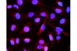 IF analysis of Alpha B Crystallin/CRYAB using anti-Alpha B Crystallin/CRYAB antibody (ABIN7601209). (CRYAB anticorps  (AA 30-151))