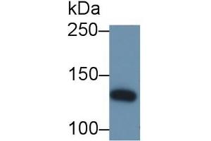 Detection of IRS1 in Bovine Cerebrum lysate using Polyclonal Antibody to Insulin Receptor Substrate 1 (IRS1)