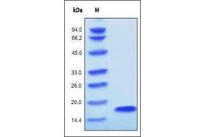 Human FGF acidic, Tag Free on SDS-PAGE under reducing (R) condition. (FGF acidic (AA 16-155) Protéine)