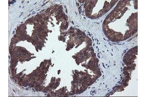 Image no. 6 for anti-Prefoldin Subunit 3 (PFDN3) antibody (ABIN1501706)