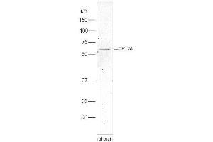 Lane 1:rat brain lysates probed with Rabbit Anti-Cytochrome P450 17A1 Polyclonal Antibody, Unconjugated  at 1:5000 for 90 min at 37˚C. (CYP17A1 anticorps  (AA 24-65))