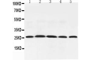 Western blot analysis of Adiponectin using anti-Adiponectin antibody . (ADIPOQ anticorps  (AA 19-244))