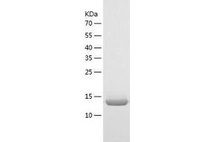 Western Blotting (WB) image for Thioredoxin-Like 4B (TXNL4B) (AA 1-149) protein (His-IF2DI Tag) (ABIN7125367)