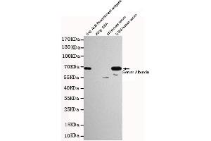 Western blot detection of Human Serum Albumin in 0. (HSA anticorps)