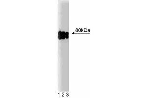 Western blot analysis of CLA-1 on a HeLa cell lysate (Human cervical epitheloid carcinoma, ATCC CCL-2. (SCARB1 anticorps  (AA 104-294))