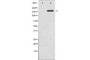 Western blot analysis of Ret expression in K562 whole cell lysates,The lane on the left is treated with the antigen-specific peptide. (Ret Proto-Oncogene anticorps  (C-Term))