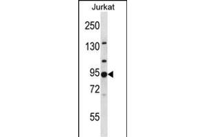 G2 Antibody (N-term) 3809a western blot analysis in Jurkat cell line lysates (35 μg/lane). (AP1G2 anticorps  (N-Term))