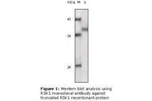 Image no. 2 for anti-Ribosomal Protein S6 Kinase, 90kDa, Polypeptide 1 (RPS6KA1) antibody (ABIN207641) (RPS6KA1 anticorps)