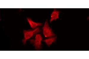 ABIN6274472 staining Hela by IF/ICC.